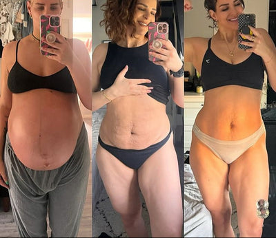 Asolla™ Postpartum Cellulite Oil